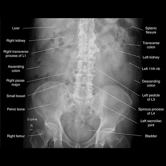 What Is The Role Of X-Rays In Abdomen?